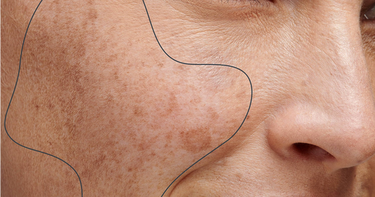 Debunking Common Skincare Myths for Mature Women